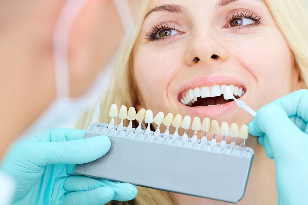 Why Professional Whitening?
