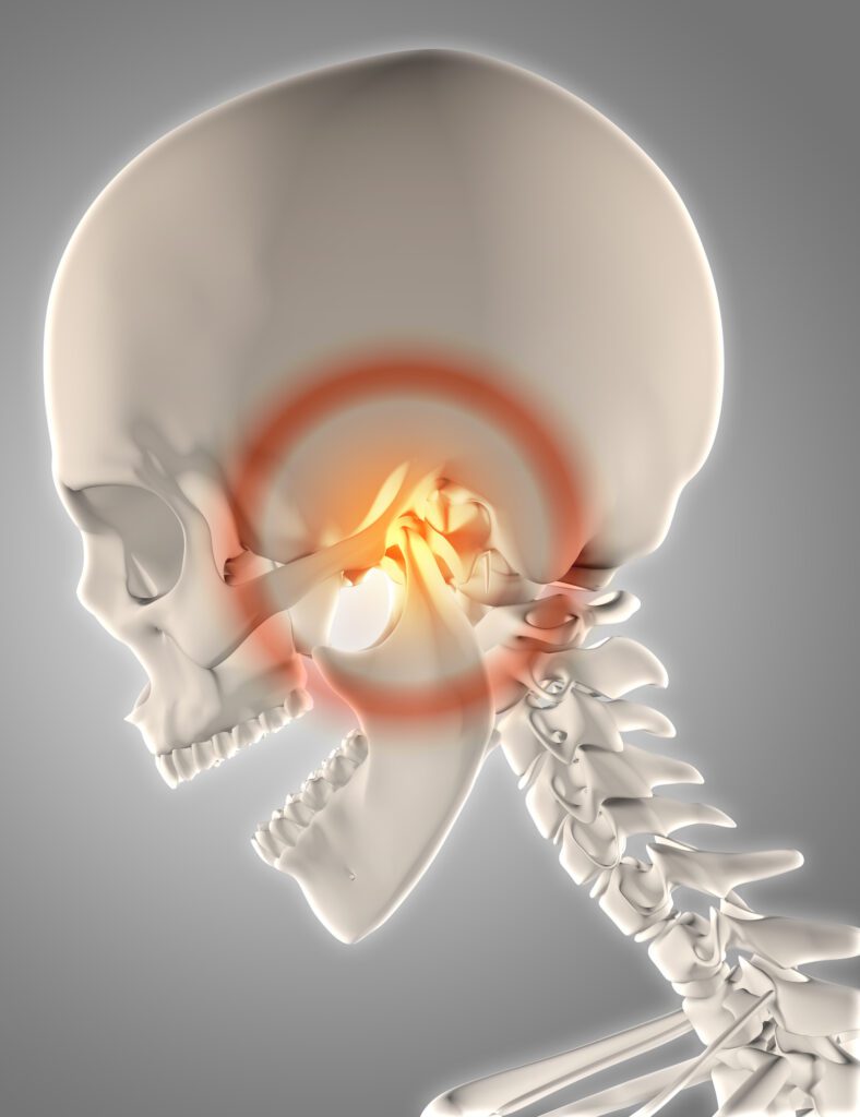 TMJ treatment in Denton, TX