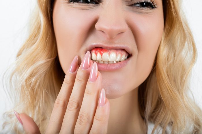 treating dental concerns in denton, texas